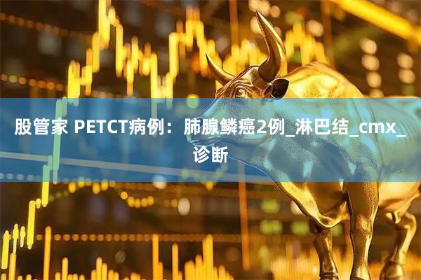 股管家 PETCT病例：肺腺鳞癌2例_淋巴结_cmx_诊断